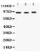 FER Tyrosine Kinase antibody, GTX12150, GeneTex, Western Blot image 