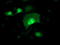 Alcohol Dehydrogenase 1B (Class I), Beta Polypeptide antibody, LS-C337333, Lifespan Biosciences, Immunofluorescence image 