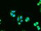Adenylate Kinase 1 antibody, MA5-24915, Invitrogen Antibodies, Immunocytochemistry image 