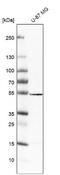 Vesicle Amine Transport 1 Like antibody, NBP1-92570, Novus Biologicals, Western Blot image 