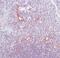 Endoglin antibody, PA5-32303, Invitrogen Antibodies, Immunohistochemistry frozen image 