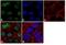 Vitamin D Receptor antibody, MA5-14617, Invitrogen Antibodies, Immunofluorescence image 