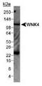 Serine/threonine-protein kinase WNK4 antibody, TA309931, Origene, Western Blot image 