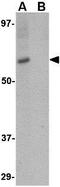 Mex-3 RNA Binding Family Member A antibody, GTX31965, GeneTex, Western Blot image 