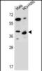 Protein Phosphatase 1 Regulatory Subunit 42 antibody, PA5-71706, Invitrogen Antibodies, Western Blot image 