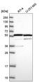 MDM4 Regulator Of P53 antibody, HPA048821, Atlas Antibodies, Western Blot image 
