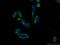 Fascin Actin-Bundling Protein 3 antibody, 13536-1-AP, Proteintech Group, Immunofluorescence image 