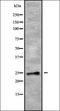 RAB28, Member RAS Oncogene Family antibody, orb338619, Biorbyt, Western Blot image 
