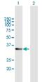Retinol Dehydrogenase 12 antibody, H00145226-B01P, Novus Biologicals, Western Blot image 