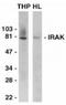 Interleukin 1 Receptor Associated Kinase 1 antibody, TA305934, Origene, Western Blot image 
