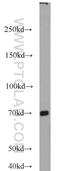 MKS Transition Zone Complex Subunit 1 antibody, 16206-1-AP, Proteintech Group, Western Blot image 