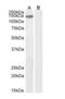 Kinesin Family Member 4A antibody, orb18420, Biorbyt, Western Blot image 