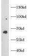 DNA-binding protein SATB2 antibody, FNab10798, FineTest, Western Blot image 