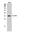 Hydroxysteroid 11-Beta Dehydrogenase 1 antibody, STJ91366, St John