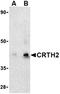 CD294 antibody, orb74796, Biorbyt, Western Blot image 