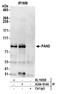Poly(A) Specific Ribonuclease Subunit PAN3 antibody, A304-914A, Bethyl Labs, Immunoprecipitation image 