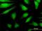 DEAD-Box Helicase 43 antibody, H00055510-M07, Novus Biologicals, Immunocytochemistry image 