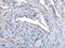 Solute Carrier Family 27 Member 4 antibody, PA5-67531, Invitrogen Antibodies, Immunohistochemistry frozen image 
