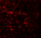Epithelial splicing regulatory protein 1 antibody, 6185, ProSci, Immunofluorescence image 