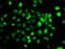 Protein Phosphatase 2 Scaffold Subunit Abeta antibody, GTX65916, GeneTex, Immunofluorescence image 