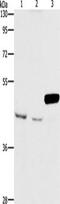Armadillo Repeat Containing X-Linked 3 antibody, TA349518, Origene, Western Blot image 