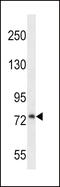 Procollagen-Lysine,2-Oxoglutarate 5-Dioxygenase 1 antibody, 56-571, ProSci, Western Blot image 