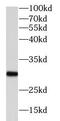 Phosphoglycerate Mutase 1 antibody, FNab09874, FineTest, Western Blot image 