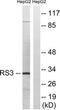 Ribosomal Protein S3 antibody, TA314475, Origene, Western Blot image 