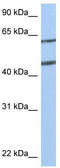 Netrin-4 antibody, TA338467, Origene, Western Blot image 