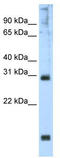 Homeobox protein Hox-B1 antibody, TA341777, Origene, Western Blot image 