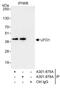 Ubiquitin Recognition Factor In ER Associated Degradation 1 antibody, A301-875A, Bethyl Labs, Immunoprecipitation image 