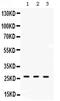 Dimethylarginine Dimethylaminohydrolase 2 antibody, PA5-79141, Invitrogen Antibodies, Western Blot image 