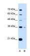 Uronyl 2-Sulfotransferase antibody, orb325286, Biorbyt, Western Blot image 