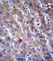 Fatty acid desaturase 2 antibody, LS-C165916, Lifespan Biosciences, Immunohistochemistry paraffin image 