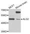 ALG2 Alpha-1,3/1,6-Mannosyltransferase antibody, A06556, Boster Biological Technology, Western Blot image 
