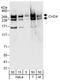 Chromodomain Helicase DNA Binding Protein 4 antibody, A301-083A, Bethyl Labs, Western Blot image 