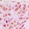 p65 antibody, LS-C352803, Lifespan Biosciences, Immunohistochemistry paraffin image 