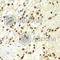 Replication Protein A2 antibody, A2189, ABclonal Technology, Immunohistochemistry paraffin image 