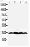 BCL2 Associated Athanogene 2 antibody, PA2099, Boster Biological Technology, Western Blot image 