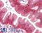CLDN7 antibody, LS-B7594, Lifespan Biosciences, Immunohistochemistry paraffin image 