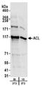 ATP Citrate Lyase antibody, A303-867A, Bethyl Labs, Western Blot image 