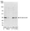 E3 ubiquitin-protein ligase CHIP antibody, A301-572A, Bethyl Labs, Western Blot image 