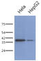 Poly(RC) Binding Protein 1 antibody, AM50069PU-N, Origene, Western Blot image 