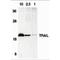 TNF Superfamily Member 10 antibody, TA305942, Origene, Western Blot image 