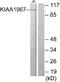 Cell cycle and apoptosis regulator protein 2 antibody, A30523, Boster Biological Technology, Western Blot image 