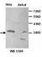 Protein Kinase AMP-Activated Non-Catalytic Subunit Gamma 1 antibody, orb77069, Biorbyt, Western Blot image 