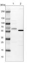 CTD Small Phosphatase Like 2 antibody, NBP1-91814, Novus Biologicals, Western Blot image 
