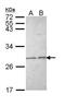 Lag antibody, PA5-29706, Invitrogen Antibodies, Western Blot image 