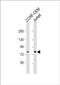 Mitochondrially Encoded NADH:Ubiquinone Oxidoreductase Core Subunit 5 antibody, PA5-72501, Invitrogen Antibodies, Western Blot image 