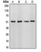 CUGBP Elav-Like Family Member 1 antibody, orb215008, Biorbyt, Western Blot image 